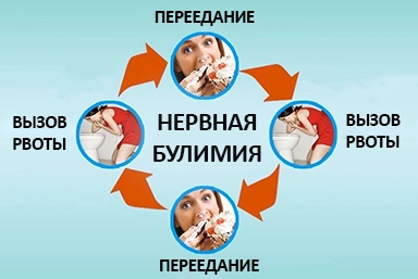 Лечение булимии в Новоульяновске